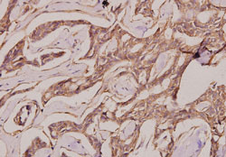 Immunohistochemistry (Formalin/PFA-fixed paraffin-embedded sections)