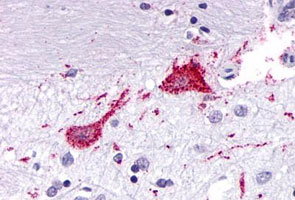 Immunohistochemistry (Formalin/PFA-fixed paraffin-embedded sections)