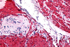 Immunohistochemistry (Formalin/PFA-fixed paraffin-embedded sections)