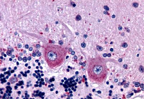 Immunohistochemistry (Formalin/PFA-fixed paraffin-embedded sections)