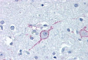 Immunohistochemistry (Formalin/PFA-fixed paraffin-embedded sections)