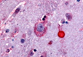 Immunohistochemistry (Formalin/PFA-fixed paraffin-embedded sections)