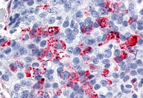 Immunohistochemistry (Formalin/PFA-fixed paraffin-embedded sections)