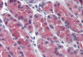 Immunohistochemistry (Formalin/PFA-fixed paraffin-embedded sections)