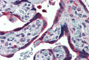 Immunohistochemistry (Formalin/PFA-fixed paraffin-embedded sections)