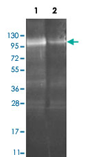 Western Blot (Recombinant protein)