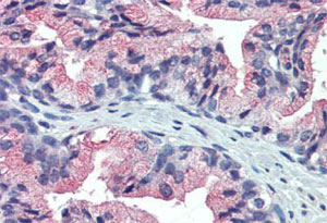 Immunohistochemistry (Formalin/PFA-fixed paraffin-embedded sections)