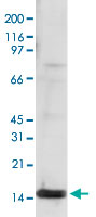 Western Blot (Cell lysate)