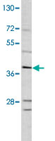 Western Blot (Cell lysate)