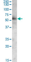 Western Blot (Tissue lysate)