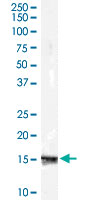 Western Blot (Cell lysate)