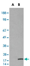 Western Blot (Transfected lysate)