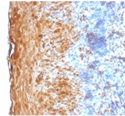 Immunohistochemistry (Formalin/PFA-fixed paraffin-embedded sections)