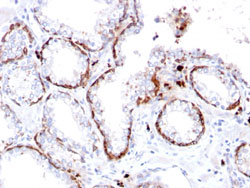 Immunohistochemistry (Formalin/PFA-fixed paraffin-embedded sections)