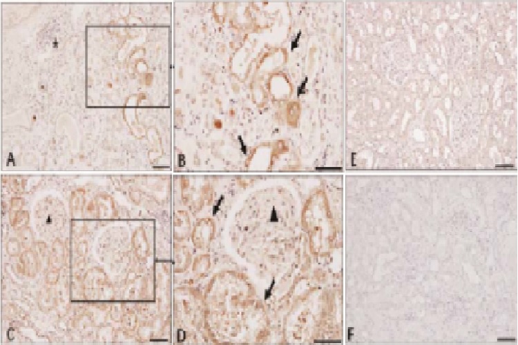 Immunohistochemistry (Formalin/PFA-fixed paraffin-embedded sections)