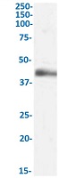 Western Blot