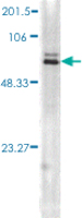 Western Blot (Tissue lysate)