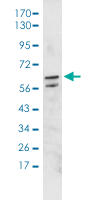 Western Blot (Transfected lysate)