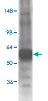 Western Blot (Tissue lysate)