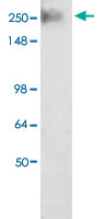 Western Blot (Tissue lysate)