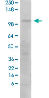 Western Blot (Tissue lysate)