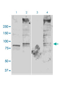 Western Blot (Tissue lysate)