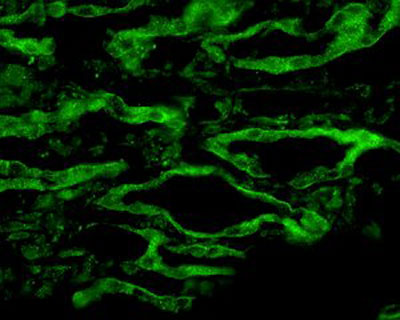 Immunofluorescence