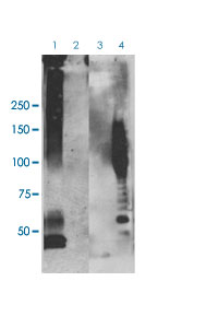 Western Blot