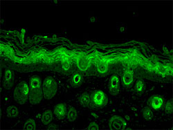 Immunofluorescence