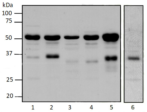 Western blot using anti-PTOX antibodies