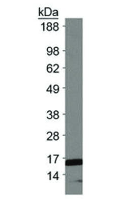 western blot using anti-H3K18me2 | Histone H3 (dimethyl Lys18) polyclonal antibodies