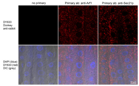 immunolocalization using Agrisera donkey anti-rabbit secondary antibody