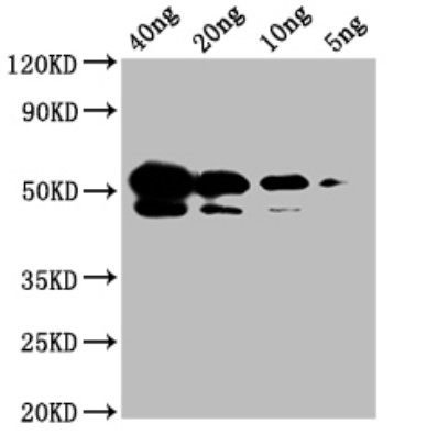 Western blot using anti Nucleoprotein N monoclonal antibodies