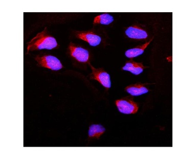 Calpain 1/CAPN1 Antibody