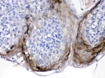 Elafin/Skalp/PI3 Antibody