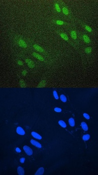 AREB6/ZEB1 Antibody