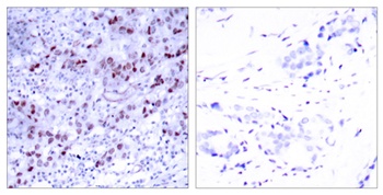 GATA-1 antibody