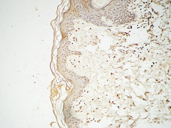 GATA-2/3 antibody