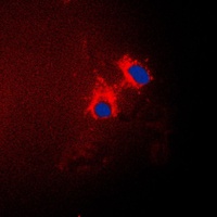 CDKN2B antibody