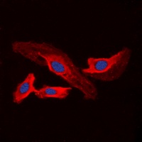 CHSY2 antibody