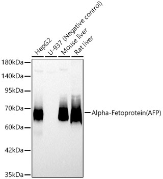 Alpha 1 Fetoprotein antibody