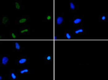 Histone H3 K18ac antibody