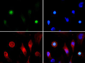 Histone H3 pT3/K4ac antibody