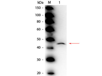 Adenosine Deaminase antibody (Peroxidase)