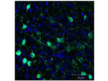 GFP antibody