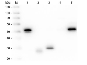 RABBIT IgG (H&L) antibody (TRITC)