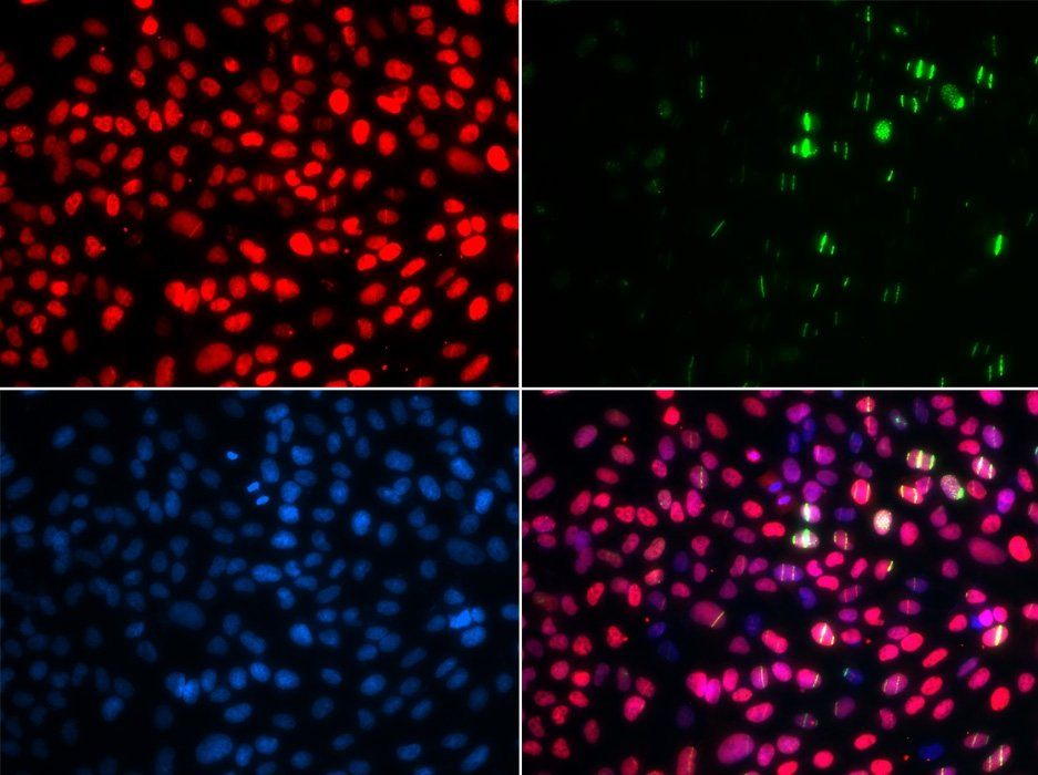 MSH6 antibody