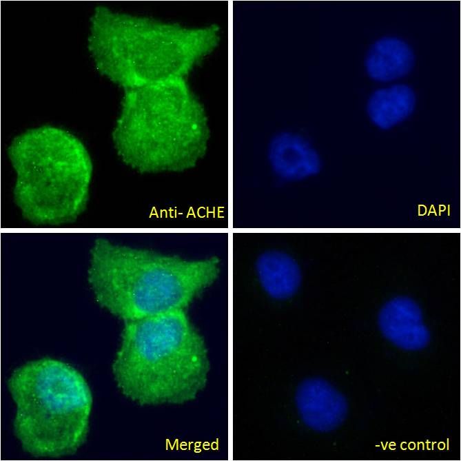 ACHE antibody