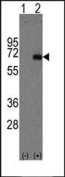 Alpha 1 Fetoprotein antibody