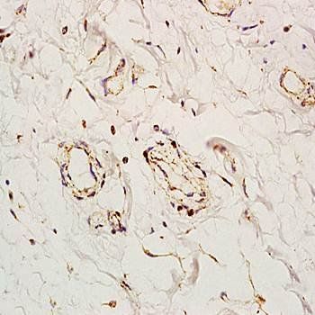 Angiomotin antibody